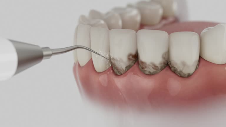 Reliable Dental Implants contractor in Orchard Mesa, CO by Smile Center Dentistry